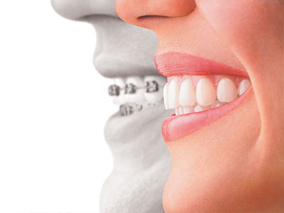 The image shows a split-screen comparison between a person s natural teeth and a set of dental implants, with one side featuring a smiling mouth displaying the implants and the other side showing a close-up of a human face with a neutral expression.