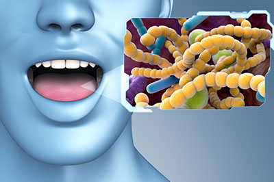 The image features a 3D rendering of a human head with an open mouth, displaying a yellowish-green substance resembling bacteria, set against a background that includes a microscopic view of a bacterium with multiple flagella and a purple and white color scheme.