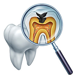 The image features a magnified view of a tooth with an open crown through which you can see the interior structure including the pulp chamber, tooth root, and surrounding gum tissue, all under a magnifying glass.