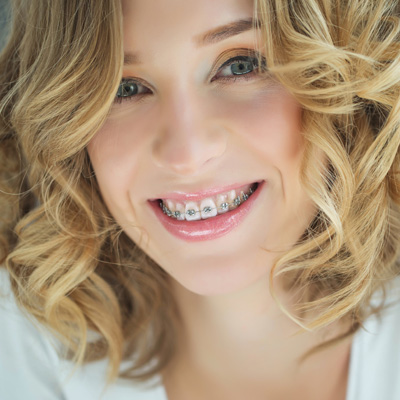 A woman with straight, white teeth is smiling at the camera.